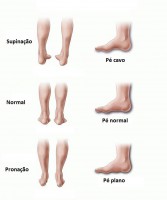 /album/ortopedia-da-pontinha/botes-jpg/